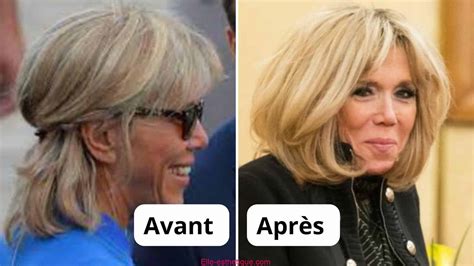 Brigitte Macron Chirurgie Esth Tique Ou Non