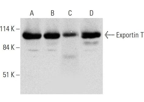 Exportin T抗体 D 11 SCBT Santa Cruz Biotechnology