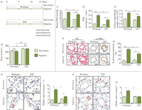 Leptin Ob Ob Main Receptor Obr B Axis Enhances Chronic