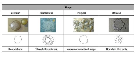 Bacterial Colony Morphology - BiokiMicroki