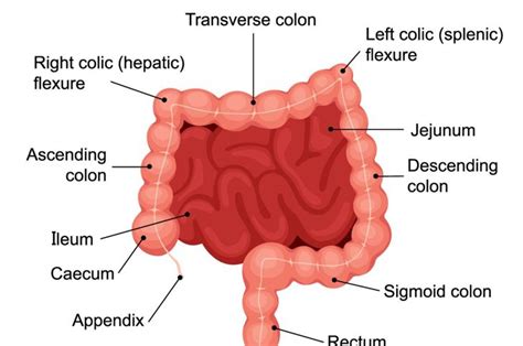 Types of Ileostomy Procedures and Possible Risks - Health & Detox ...