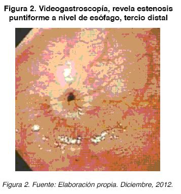 Revista De Investigaci N E Informaci N En Salud Perforaci N Esof Gica