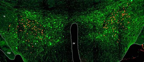 Mapping The Hypocretinorexin Neuronal System An Unexpectedly