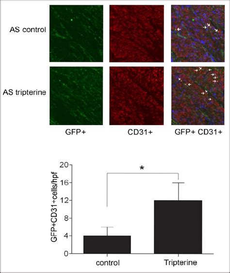 Immunofluorescence Staining Of GFP CD31 Double Positive Cells In