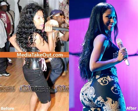 Nicki Minaj Plastic Surgery Before And After Celebrity Dr