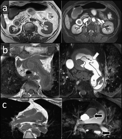 Essentials Of Forensic Post Mortem Mr Imaging In Adults Pmc