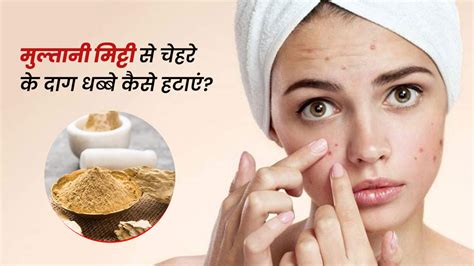 चेहरे पर हैं दाग धब्बे तो इन 4 तरीकों से इस्तेमाल करें मुल्तानी मिट्टी How To Remove Dark