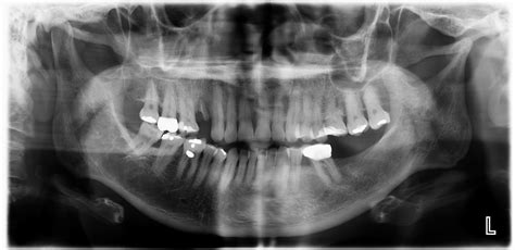 Ceroma Centro De Radiolog A Oral Y M Xilofacial Radiografia