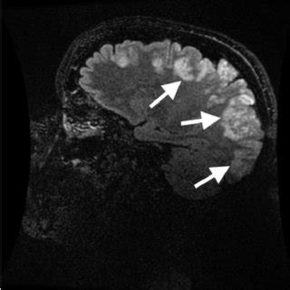 T Weighted Magnetic Resonance Imaging Of Patient On Hospital Day