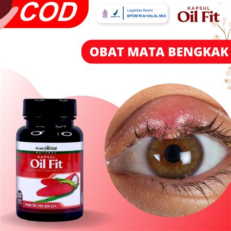 Jual Obat Mata Bengkak Obat Mata Bintittan Obat Radang Kelopak Mata