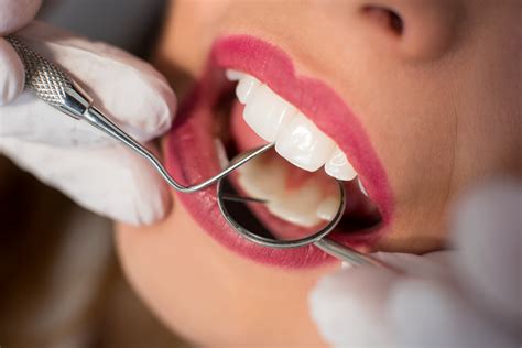 Cuidados Despu S De Un Tratamiento De Endodoncia Cl Nica Dental Gramadent