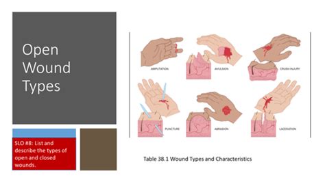 Fundamentals Wounds Flashcards Quizlet