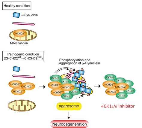 New Insights Into The Development Of Parkinsons Disease In The Brain