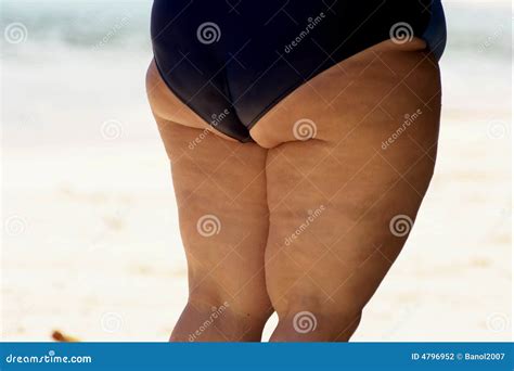 Obese Woman Cellulite Legs Stock Photo Image Of Health Legs 4796952