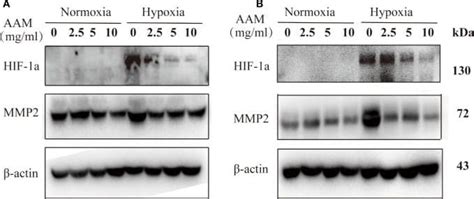 HIF 1 Alpha Antibody H1alpha67 NB100 105 By Novus Part Of Bio Techne