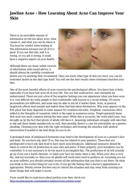 Jawline Acne Treatment