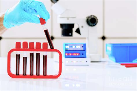 Blood Testing 11 Photograph By Wladimir Bulgarscience Photo Library