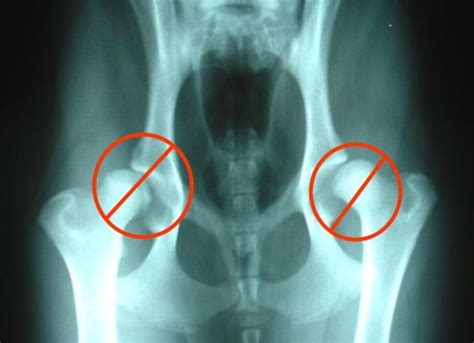 Severe Hip Dysplasia In Dogs