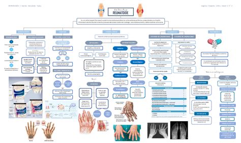 Artritis Reumatoide Cuadro conceptual de AR REUMATOLOGÕA Snchez