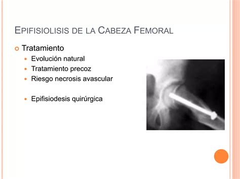 Patología de la Cadera infantil PPT