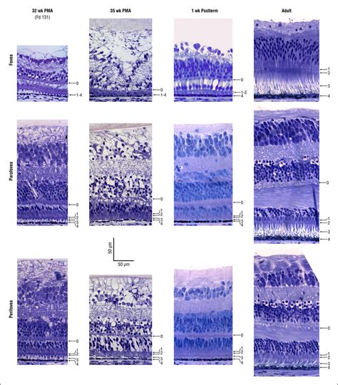 Time Course Of Photoreceptor Maturation At Foveal Top Row Parafoveal