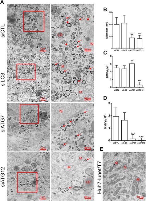 The Impact Of Lc Atg Or Atg Silencing On Membranous Web