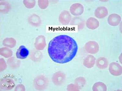 Hematopoiesis and Bone Marrow Histology - Myeloblast - histology slide