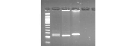 Identification Of The Thr150ile Mutation In The Mc4r Gene In Sscp Download Scientific Diagram