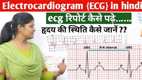 Ecg Test रिपोर्ट कैसे पढ़ें What Is Ecg Report In Hindi Electrocardiogram Report Kaise