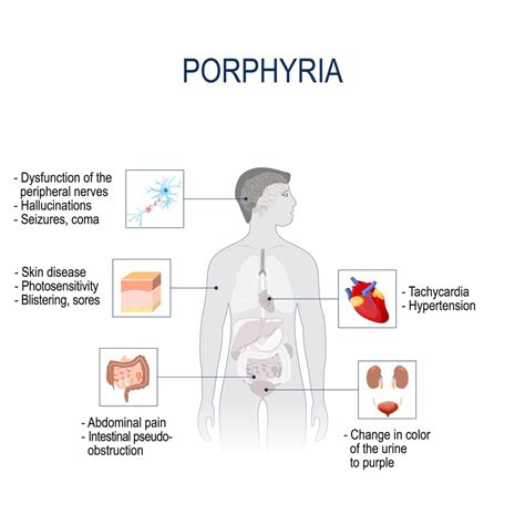 What Is Porphyria? | PainScale