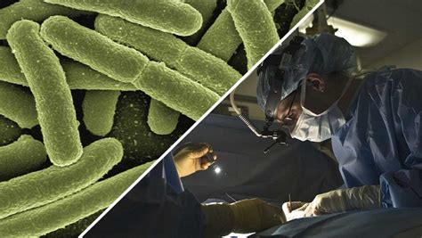 Las Superbacterias Serán La Principal Causa De Muerte En 2050