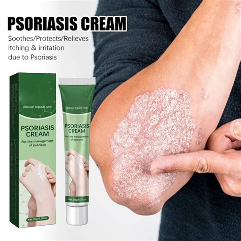 Qual A Melhor Pomada Para Psoríase - 20g Pomada Anti-Itch Psoríase Dermatite Pruritus Creme De Tratamento ...