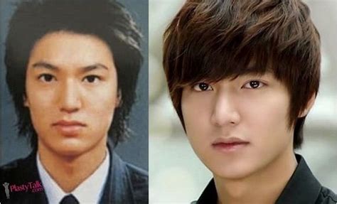 Korean Actors Actresses Before And After Plastic Surgery K Drama Amino