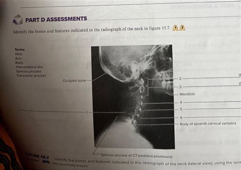 Solved Part D Assessments Identify The Bones And Features Chegg