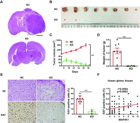 MAP4K1 Of Glioblastoma Multiforme Cells Promotes Glioma Growth In Vivo