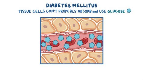 Diabetes Mellitus Type 1 Video And Meaning Osmosis