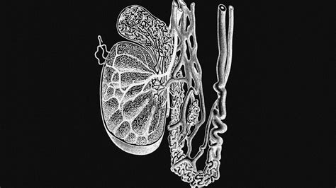 Spermatocele: What it is, causes, treatments