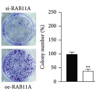 Rab A Promotes Prostate Cancer Cell Proliferation A The Mrna And