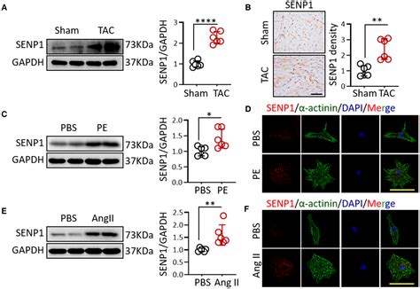 SENP1 Protects Against Pressure OverloadInduced Cardiac Remodeling And