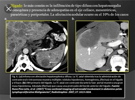 Pin By Liznel Feliberty On Imagenes De Ct Scan Y Mri Ct Scan Movie