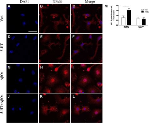 Ht Prevents Ao Induced Nuclear Translocation Of Nfb P Subunit In