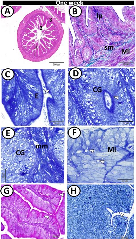 T.S in the proximal part of caeca at one-week post-hatching. (A) Shapes ...