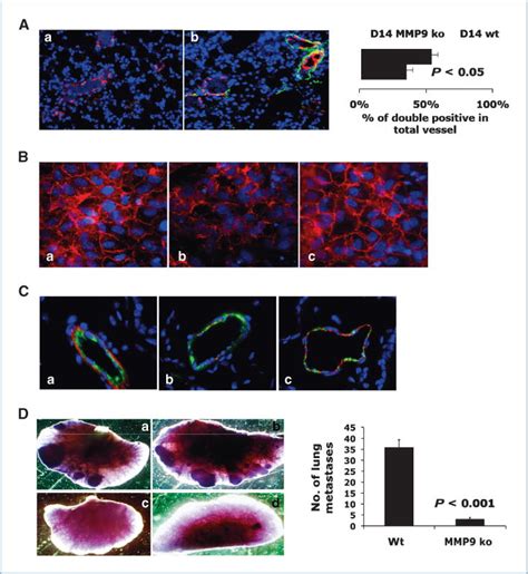 Gr 1 CD11b Myeloid Cells Tip The Balance Of Immune Protection To Tumor