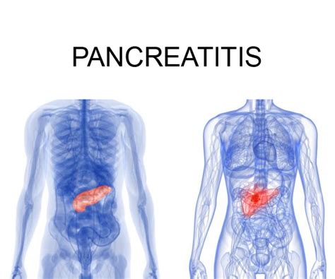 Pancreas Pain Location