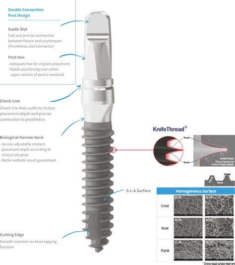 Advanced Intermezzo Megagen Implant