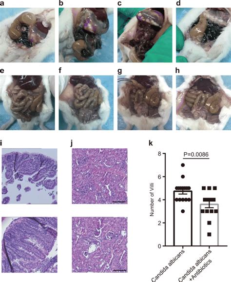 Pretreatment with antibiotics aggravates fungal infection in newborn ...