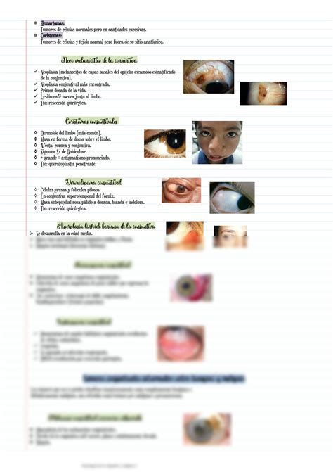 SOLUTION Patolog A De La Conjuntiva 2 Studypool