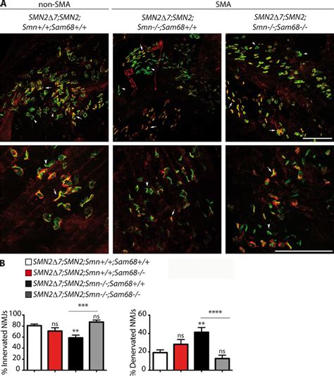 Ablation Of Sam68 Ameliorates Innervation Of Nmjs A Nmj