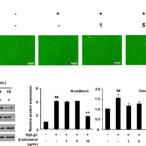 β Sitosterol Suppresses Tgf β1 Induced Emt In Alveolar Epithelial A549