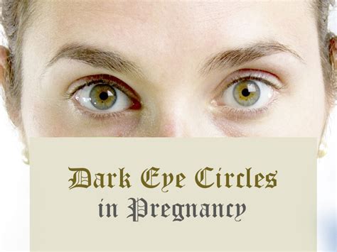 Dark Eye Circles During Pregnancy 3 Best Treatments